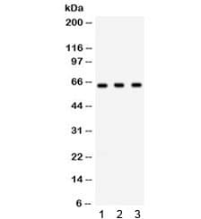 CHEK2 / CHK2 Antibody