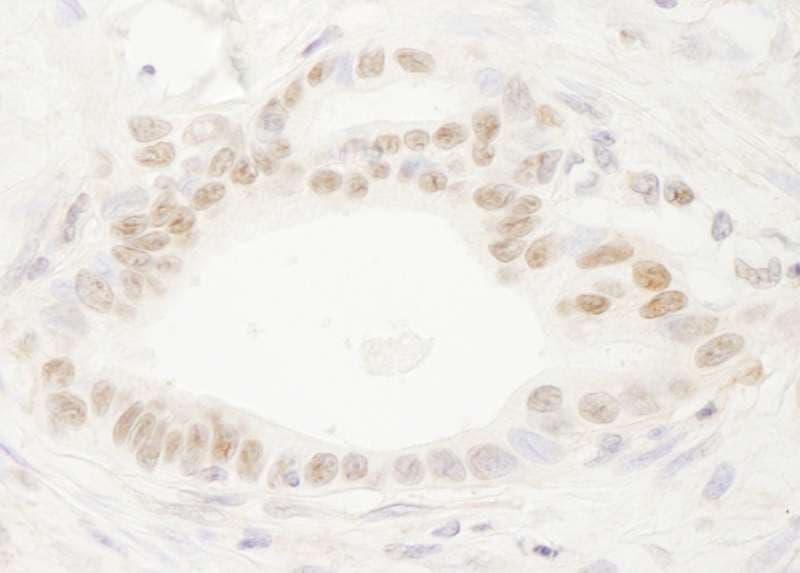 Polyclonal Rabbit anti-Human DEK Antibody (aa325-375, IHC, WB)