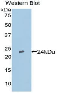 TIMP2 Antibody (aa27-220)