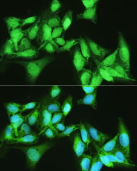 KDM7A / JHDM1D Antibody