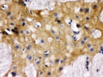 Polyclonal Rabbit anti-Human STXBP1 / MUNC18-1 Antibody (IHC, WB)