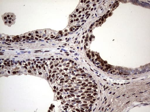 MYF5 / MYF 5 Antibody (clone OTI2G5)