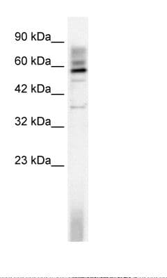 Polyclonal Rabbit anti-Human TAF15 Antibody (aa183-232, WB)