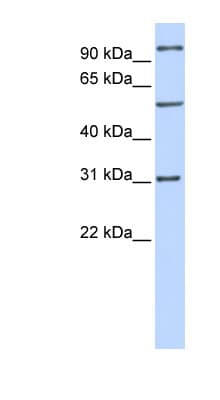 RAI14 Antibody (aa648-697)