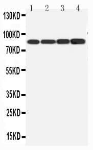 Polyclonal Rabbit anti-Human PIK3R1 / p85 Alpha Antibody (aa65-80, WB)