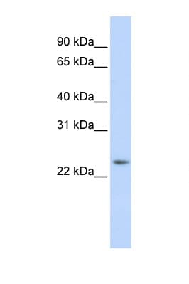 RAB8A / RAB8 Antibody (C-Terminus)