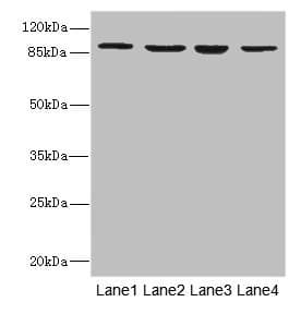 ITGB7 / Integrin Beta 7 Antibody