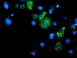 DLD / Diaphorase / E3 Antibody (clone OTI6G6)