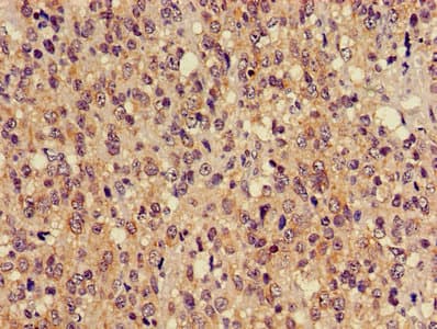 TUBA3C / Tubulin Alpha 3C Antibody