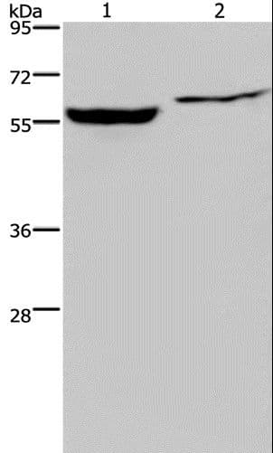 Polyclonal Rabbit anti-Human IMPDH1 Antibody (IHC, WB)