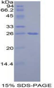 Mouse GRB7 Protein (Recombinant His-T7)