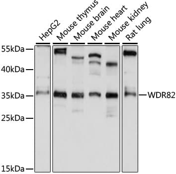 Polyclonal Rabbit anti-Human WDR82 / TMEM113 Antibody (WB)