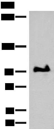 GANC Antibody