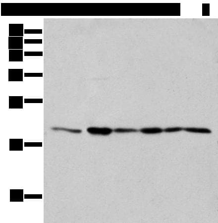 EEF1E1 / AIMP3 Antibody