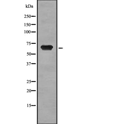 GP1BA / CD42b Antibody
