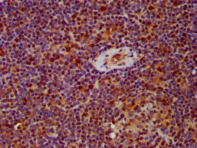 HNRNPAB Antibody