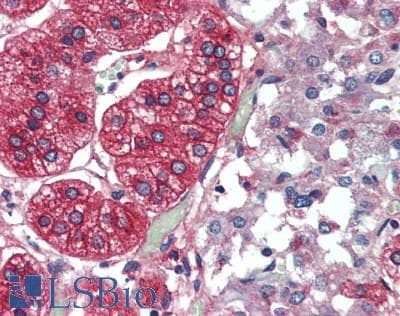 IHC-plus™ ADGRF5 / GPR116 Antibody (N-Terminus)