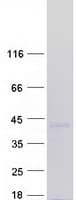 Human MEOX1 Protein (Recombinant Myc-DDK (Flag))