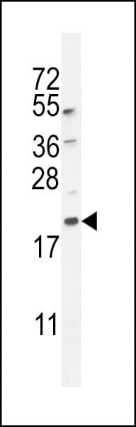 IHC-plus™ Polyclonal Rabbit anti-Human MAP1LC3B / LC3B Antibody (aa100-125, IHC, IF, WB)