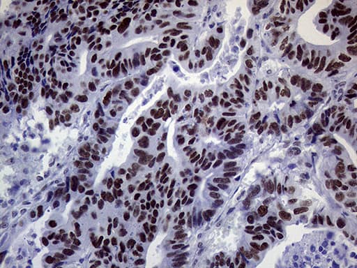 ERCC3 / XPB Antibody (aa191-436, clone OTI6H8)