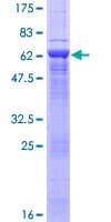 Human ARPM1 Protein (Recombinant GST)