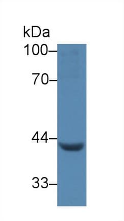 LEFTYB / LEFTY1 Antibody (aa43-364)