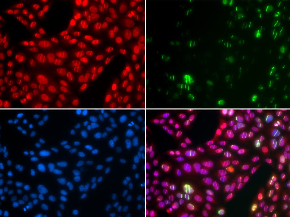 Cullin 4B / CUL4B Antibody