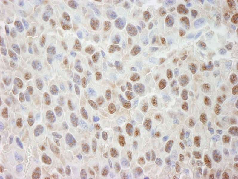 Cullin 4A / CUL4A Antibody (aa700-C-term)