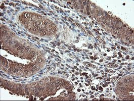 Monoclonal Mouse anti-Human PNPO Antibody (clone OTI1G9, IHC, WB)