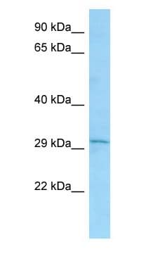 Latexin / MUM Antibody (aa153-202)