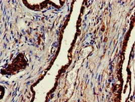 Polyclonal Rabbit anti-Human CLINT1 Antibody (IHC, WB)