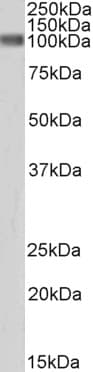 IHC-plus™ CTNNB1 / Beta Catenin Antibody