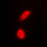 Polyclonal Rabbit anti-Human DAXX Antibody (Internal, IHC, IF, WB)