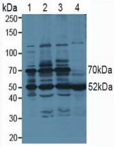 PSMC3 Antibody (aa2-439)