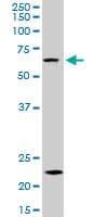Monoclonal Mouse anti-Human ZKSCAN3 / ZNF306 Antibody (clone 2A5, WB)