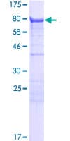 Human KLC3 Protein (Recombinant GST)