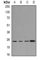 CLIC1 / NCC27 Antibody