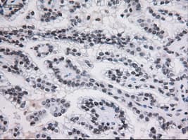 STAT3 Antibody (clone OTI21E7)