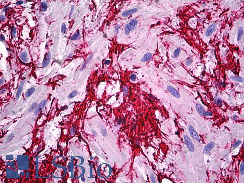 IHC-plus™ Monoclonal Mouse anti-Human FBN1 / Fibrillin 1 Antibody (clone 26, aa45-450, IHC, IF, WB)