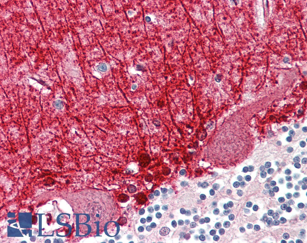 IHC-plus™ Polyclonal Rabbit anti-Human MED21 Antibody (aa71-120, IHC)