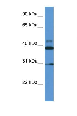 VASP Antibody (aa127-176)