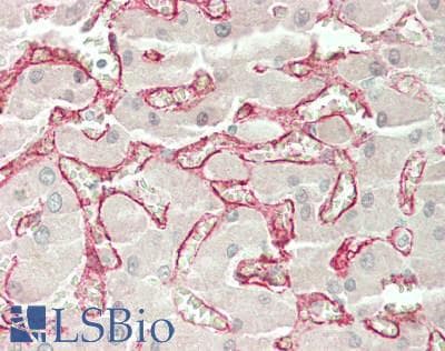 IHC-plus™ CD209 / DC-SIGN Antibody (clone 5D7)