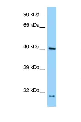 PRPF18 Antibody (N-Terminus)