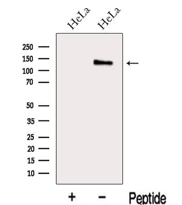 Polyclonal Rabbit anti-Human MAP1S Antibody (WB)