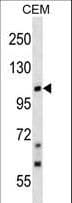 TRPC7 Antibody (aa834-862)