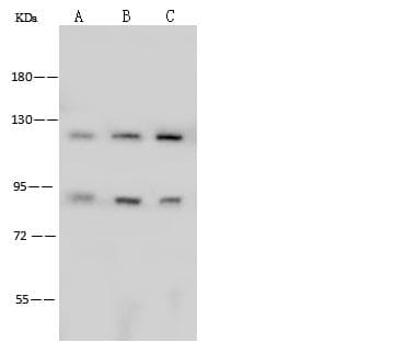 PFKP Antibody