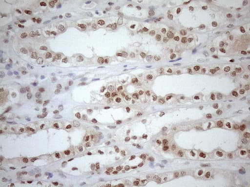 Monoclonal Mouse anti-Human MGMT Antibody (clone OTI2F10, IHC, WB)
