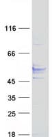 Human TMEM25 Protein (Recombinant Myc-DDK (Flag))