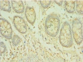 ADCK3 / CABC1 Antibody (aa1-220)