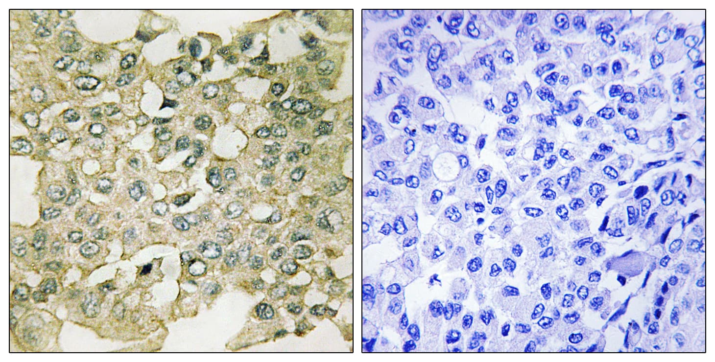 PKMYT1 Antibody (phospho-Ser83)